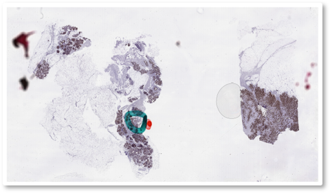 The Impact of Digital Image Quality on HER2 Diagnosis Concordance in Invasive Breast Carcinoma
