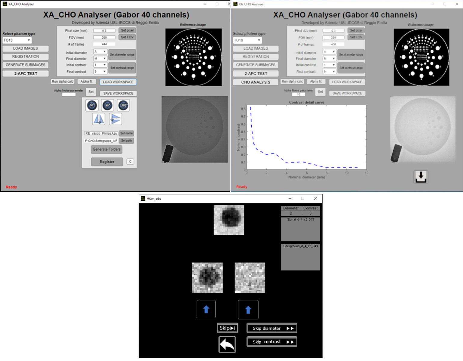 Assessment of Clinical X-Ray Angiography Protocols Employing A Model Observer Approach 