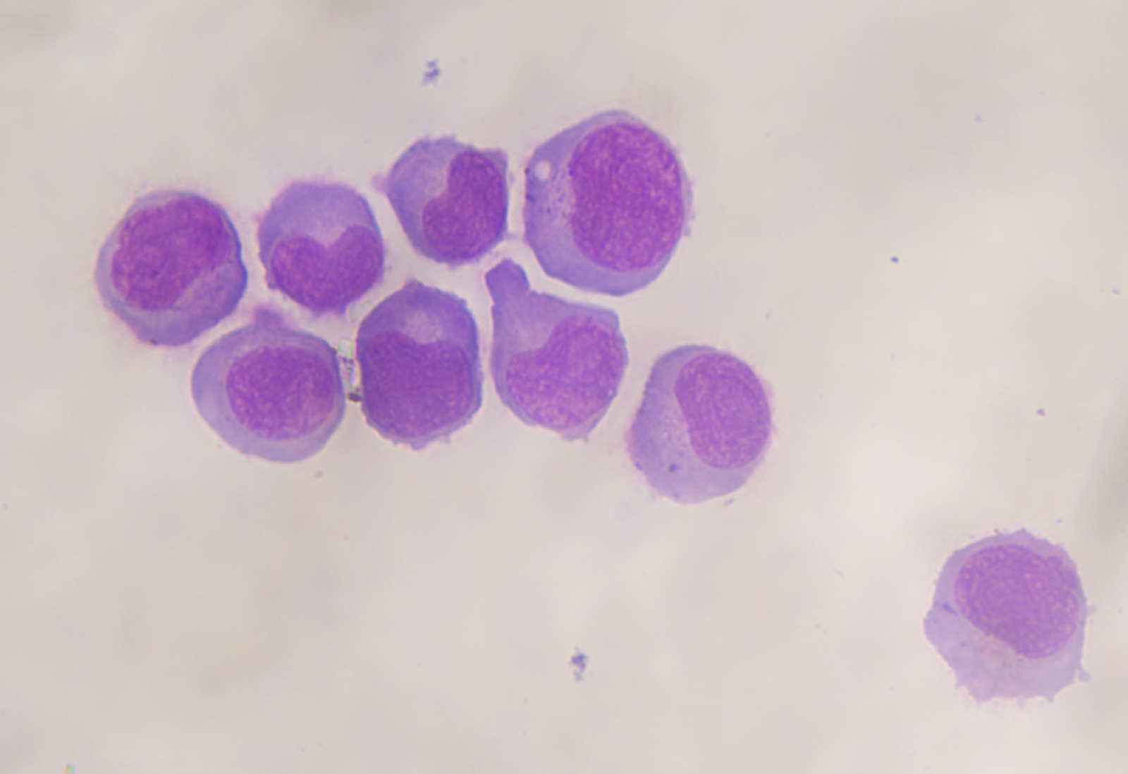 Molecular Hematology