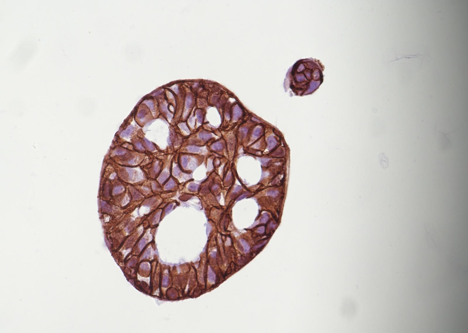 Molecular Oncology