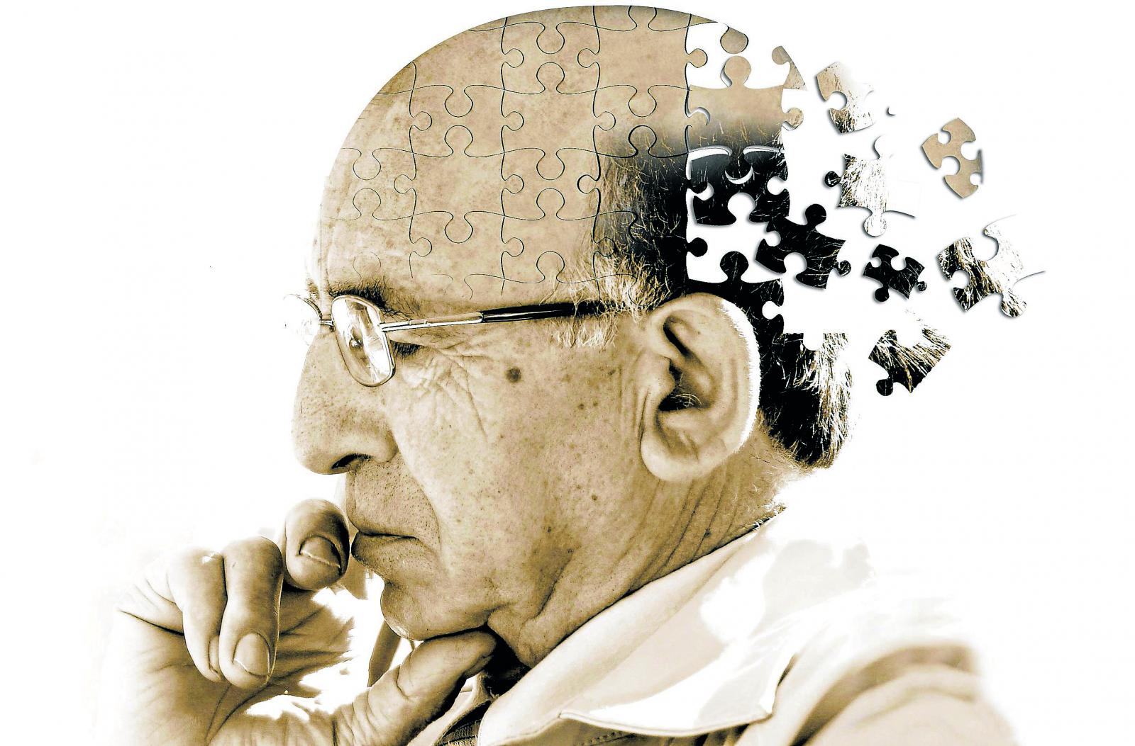 Alzheimer e demenza