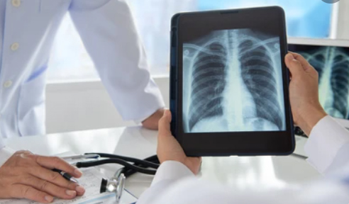 Esami radiologici, dal 1°Marzo cambiano le regole d’accesso per minorenni e pazienti con tutore legale